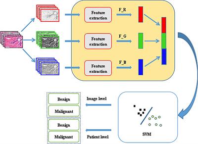 Breast Cancer Histopathological Images Recognition Based on Low Dimensional Three-Channel Features